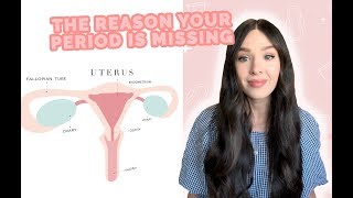 The MAIN Reason Periods Go Missing! (Late periods & missing periods)