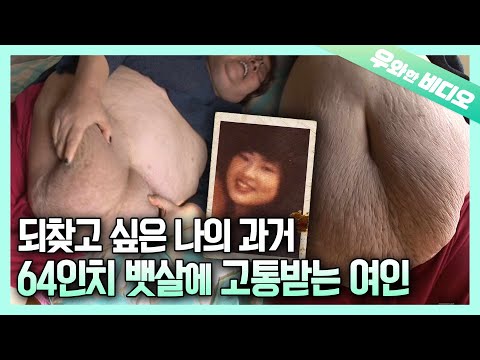 , title : '몸무게 160kg 허리 64인치, 흘러넘치는 뱃살에 고통받는 여인┃160kg (352lbs) Woman Suffers Due to Her Drooping Stomach'