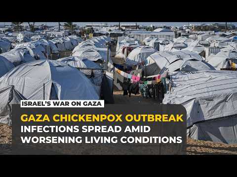 Chickenpox outbreak spreads across Gaza’s overcrowded tent camps