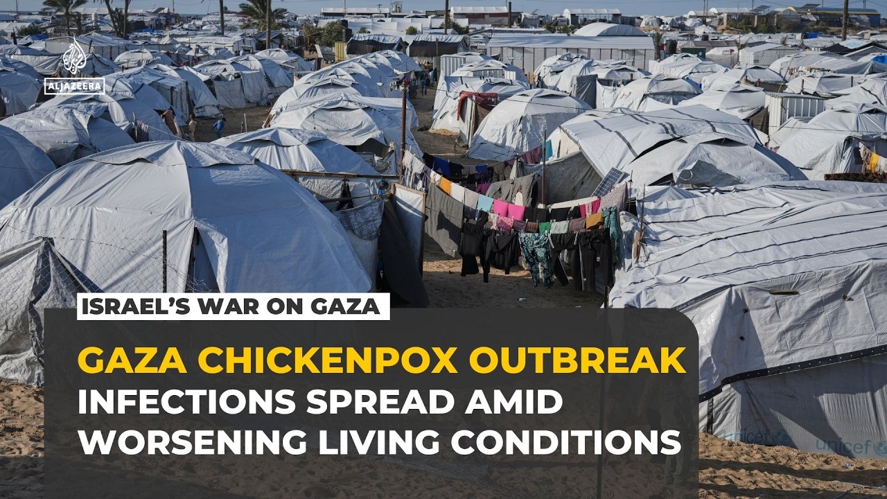 Chickenpox outbreak spreads across Gaza’s overcrowded tent camps
