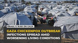 Chickenpox outbreak spreads through Gaza's overcrowded displacement camps