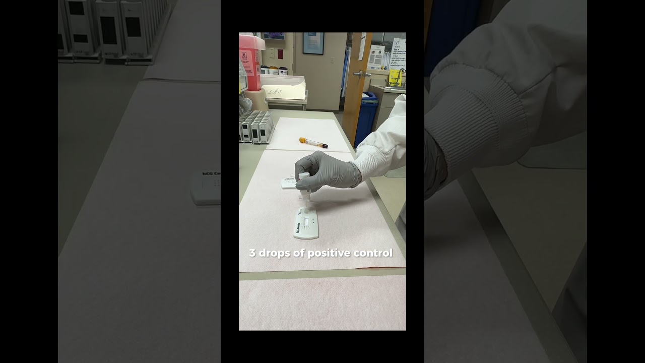 HOW TO: HCG test 👶🏻 #medicallaboratory #lablife #pregnancytest