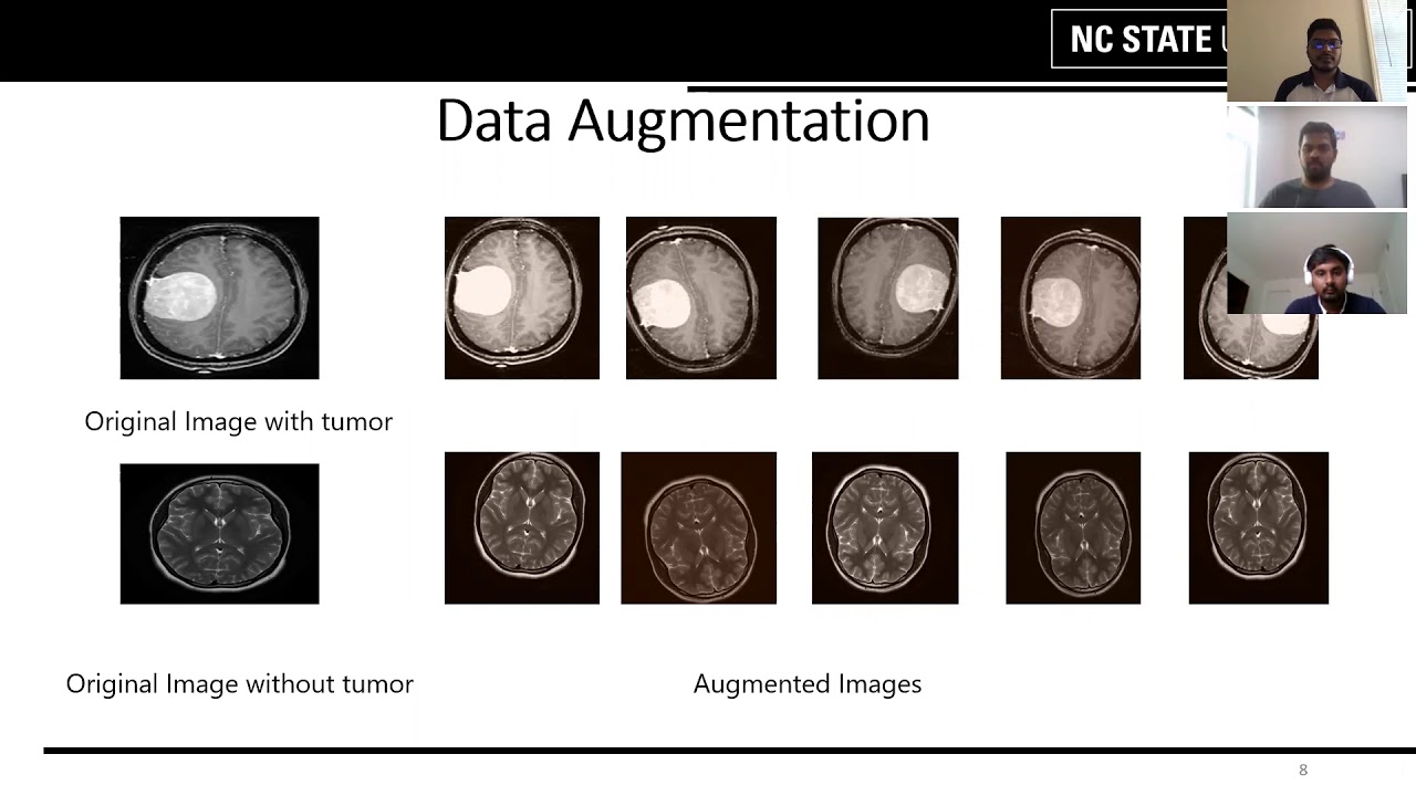 Brain Tumor Detection using Convolutional Neural Network