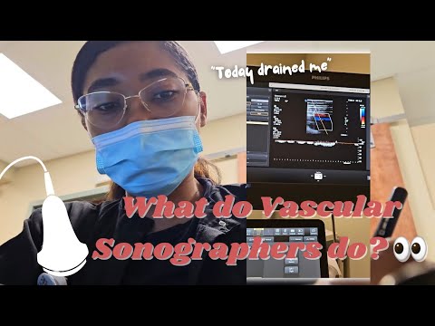Day in the Life of a Vascular Technologist in an Outpatient Facility | I'm TIRED