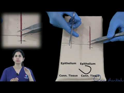 Figure of eight suture demonstration