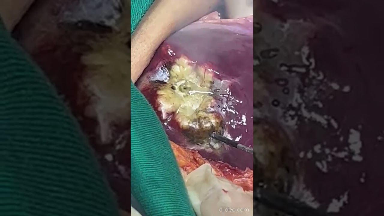 Alexander Alonso Lázaro Chumbe-34