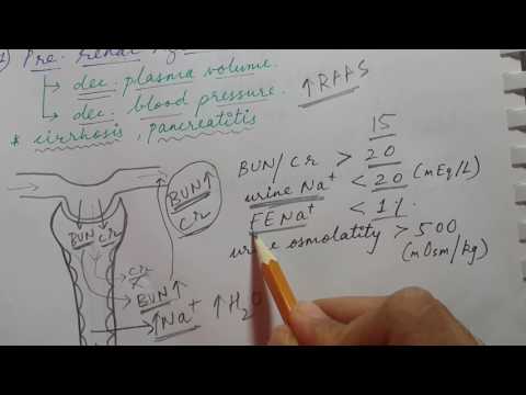 ACUTE KIDNEY INJURY | Pre-renal, Intrinsic renal and Post-renal azotemia | USMLE STEP 1