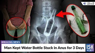 Man Kept Water Bottle Stuck in Anus for 3 Days s