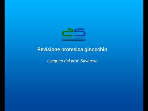 Che per il trattamento di articolazioni dolenti quando i piedi Come rompere il video congiunto