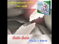 อาการ