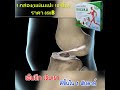อาการ