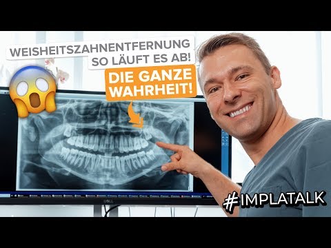 Weisheitszahnentfernung - So läuft es ab! Und wann müssen Weisheitszähne wirklich raus?
