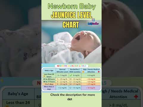 Newborn Bilirubin Levels SAFE or DANGEROUS | Normal Range & Treatment Chart | नवजातशिशु पीलिया