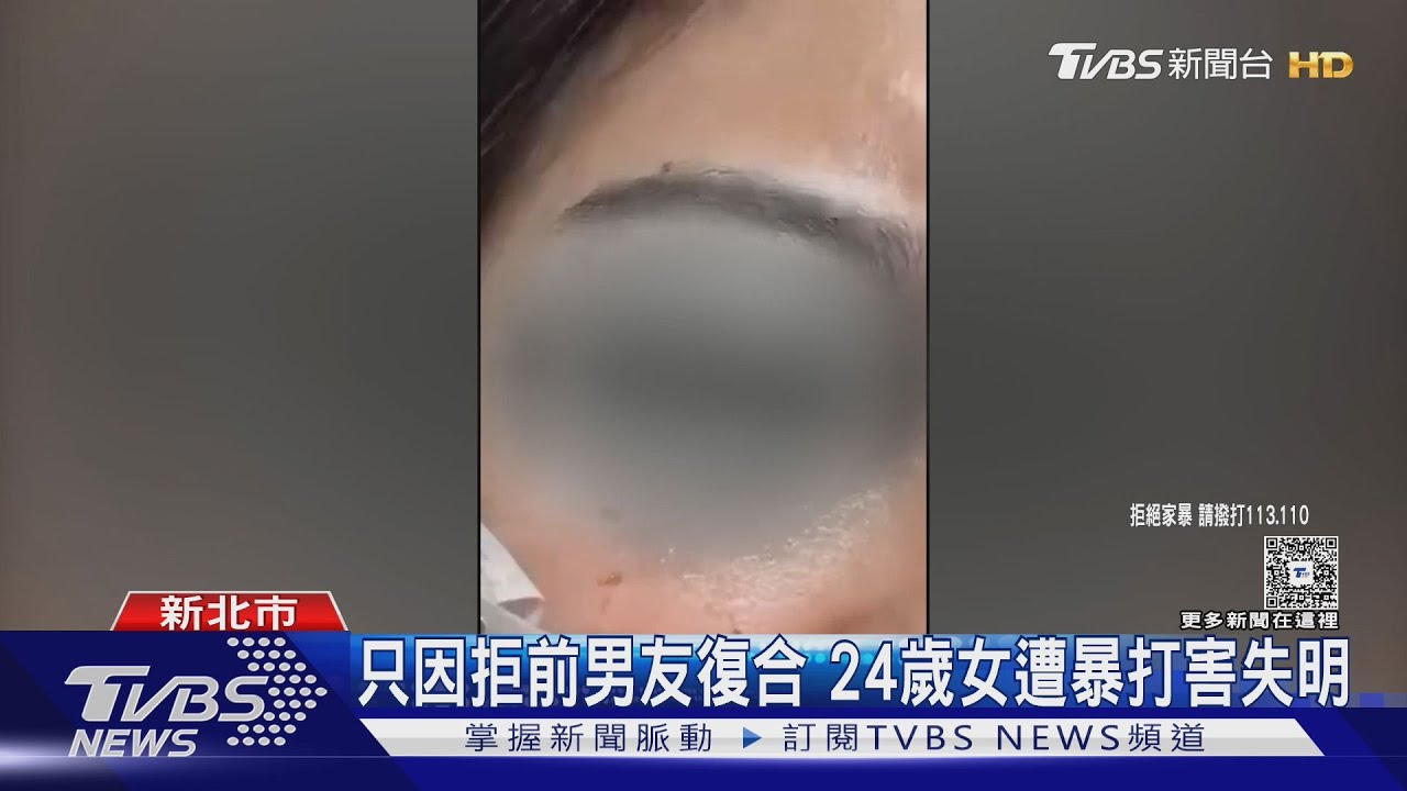 只因拒前男友復合　24歲女遭暴打害失明
