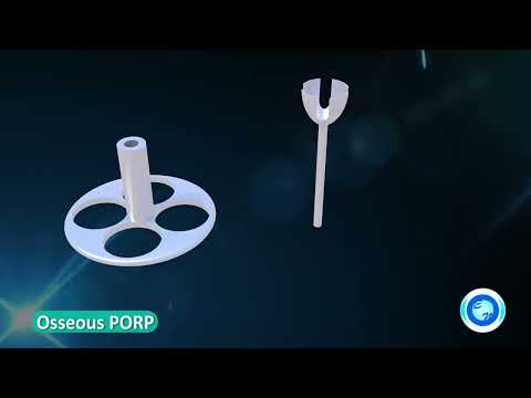 Eon Meditech's Tita-Prosthesis type Partial Vario Campana PORP