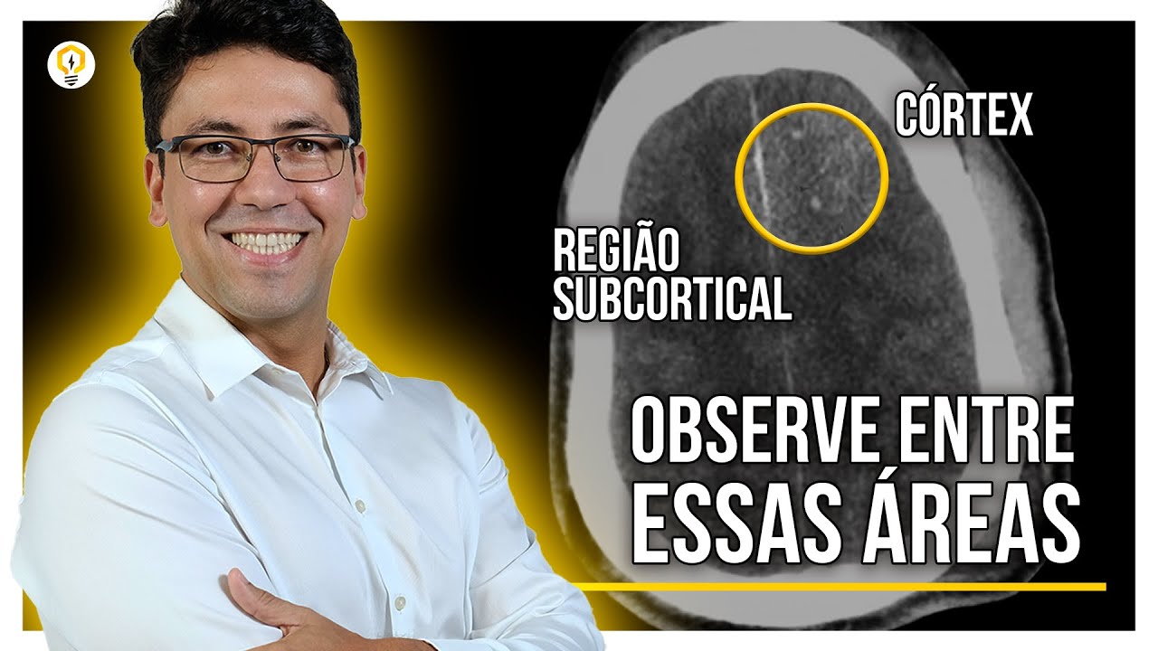 Aprenda a Procurar LESÃO AXONAL DIFUSA