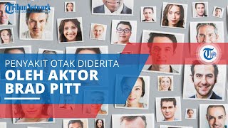 Prosopagnosia, Kesulitan untuk Mengenali Wajah Orang Lain akibat Kerusakaan pada Otak