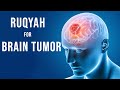 Ruqyah For Brain Tumor Healing Through Listening Ruqyah Helpline