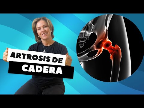 ARTROSIS DE CADERA