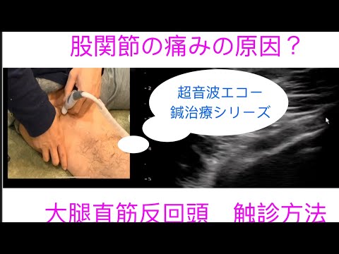 大腿直筋反回頭　股関節痛の原因⁈
