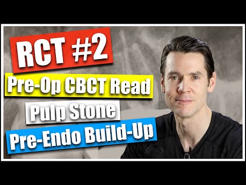 Root Canal Treatment #2: CBCT Endo Overread, Pulp Stone, Pre-Endo Build-Up