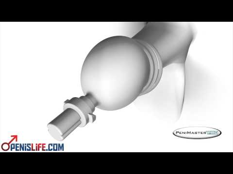 download lagu mp3 mp4 Elargisseur De Vagin, download lagu Elargisseur De Vagin gratis, unduh video klip Elargisseur De Vagin