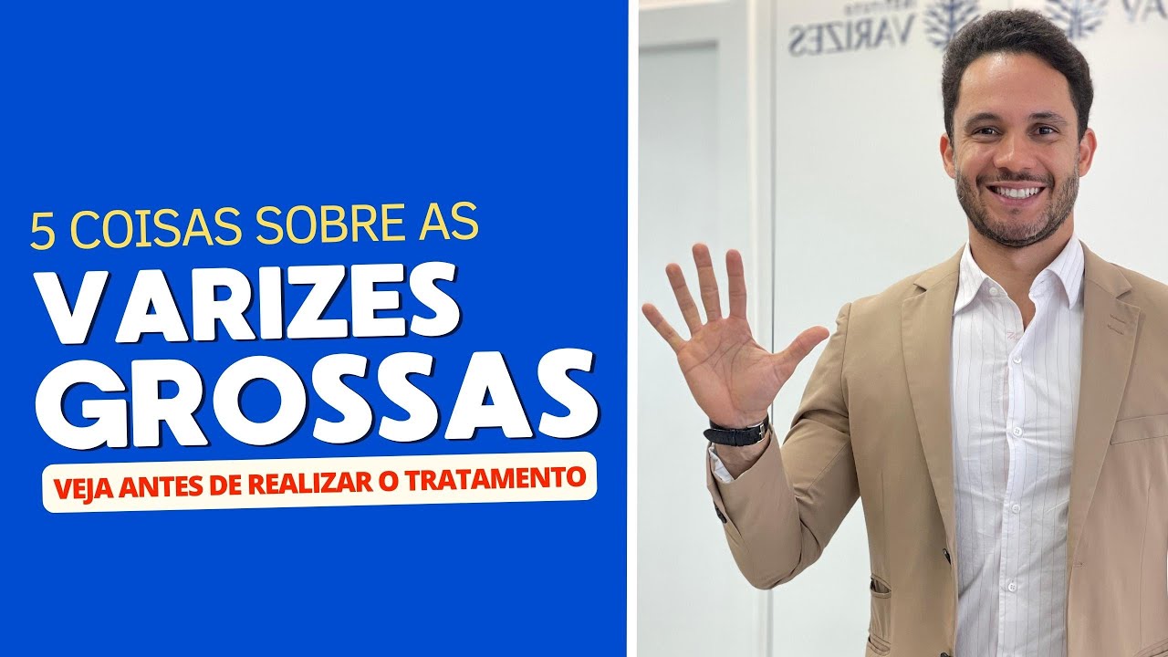 Varizes grossas: cinco coisas que você precisa saber antes de fazer o tratamento   #varizes