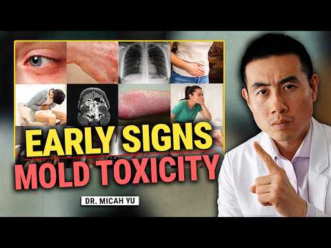 Early Warning Signs of Mold Toxicity