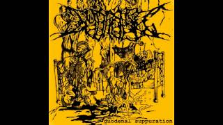 Hydropsy - Worms (Mortician Cover)