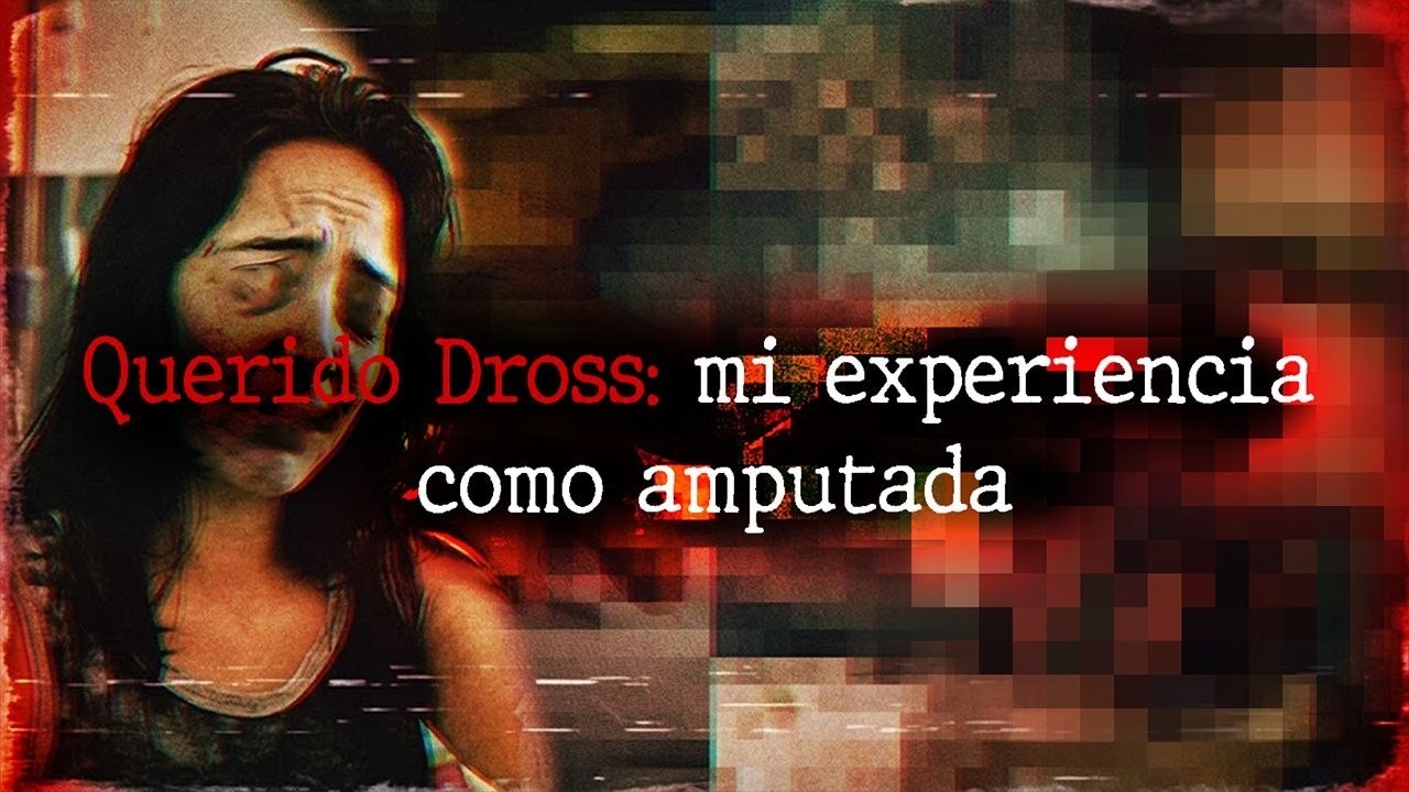 Querido Dross mi experiencia como amputada