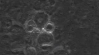 preview picture of video 'Trypanosoma cruzi trypomastigotes emerging in tissue culture'