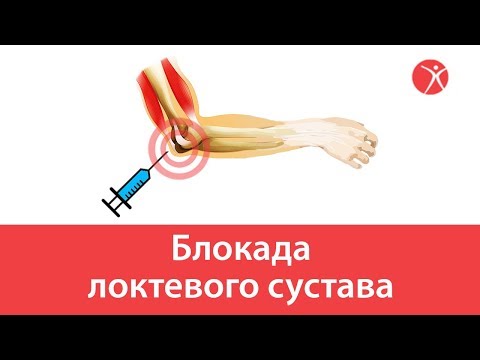 Люберцы медицинский центр лечения позвоночника и суставов Крем для востановления суставов
