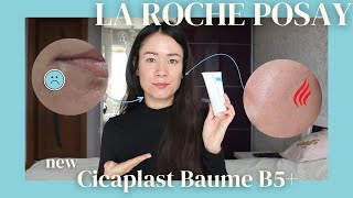 La Roche Posay's NEW Cicaplast Baume B5+ Review | Before & Afters | Mini Review of the OG