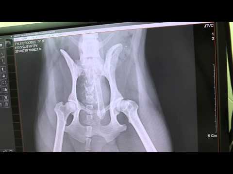 Congestione nasale con malattie degenerative del disco cervicale Che sono necessari per la chirurgia del ginocchio calze