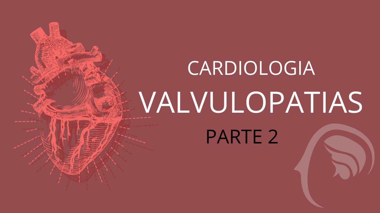 Cardiologia -  Aula de Valvulopatias (Estenose Mitral) - Parte 2