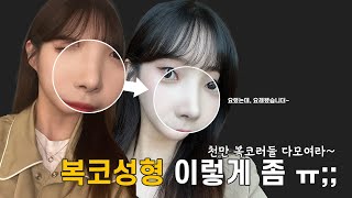 코성형 AtoZ 다 알려주는 친절한 예린씨[복코성형]