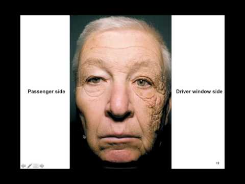 Chapter 53 Alterations in the Integumentary System