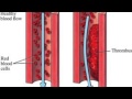 Blood Thinning And Clotting Process