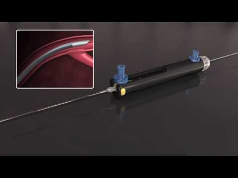 Roxwood Medical CenterCross ULTRA