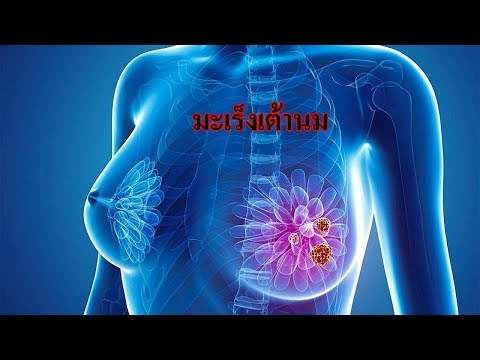 เต้านมเทียมบาง หน้าอกพลาสติกทะเล