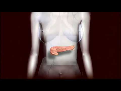 Screenshot of video: Diabetes - medical overview