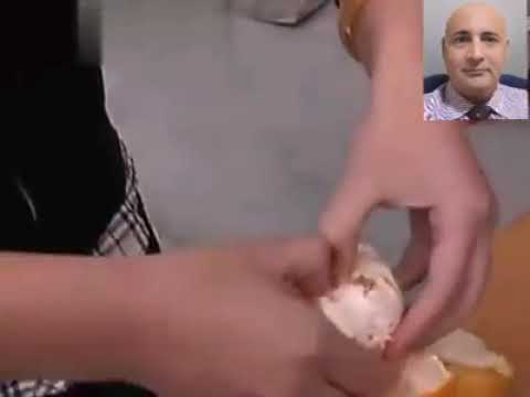 Eat the oranges with safely