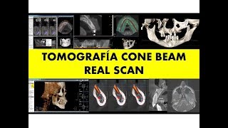 TOMOGRAFÍA CONE BEAM por el Dr. Luis Diaz