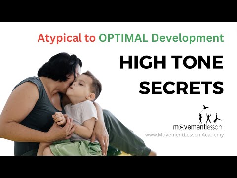 Atypical Development Baby and Hypertonia Muscle Tone or High Tone Baby - Stiff Baby