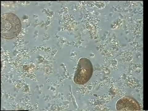 Peranema visiting a shell of Arcella