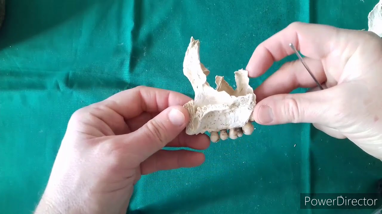 TP N° 19 Huesos de la cara.  Dr. Luciano Esborrat