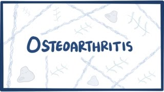 Osteoarthritis - Causes, Symptoms, Diagnosis, Treatment & Pathology