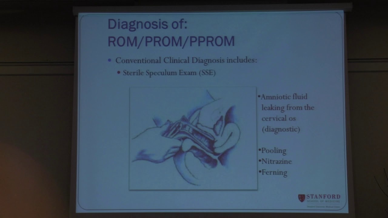 PPROM diagnostics - McQuivey