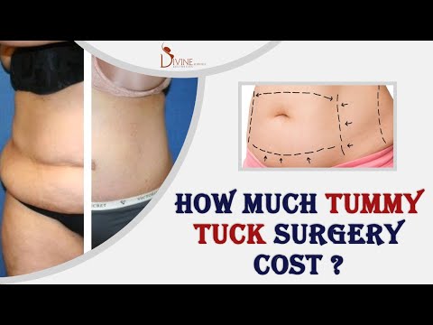 Cost of Tummy Tuck Surgery