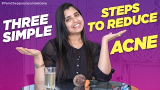 Acne కి చక్కటి సొల్యూషన్ | Skin Care Tips by #AnchorSyamala